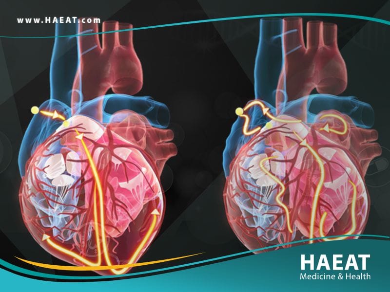 تقويم نظم القلب بالصدمة الكهربائية | 5 فوائد 26 تقويم نظم القلب بالصدمة الكهربائية
