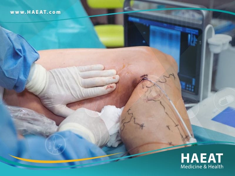 جراحة الأوعية الدموية