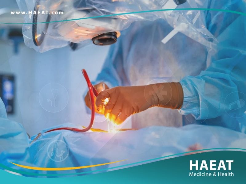 جراحة الأوعية الدموية