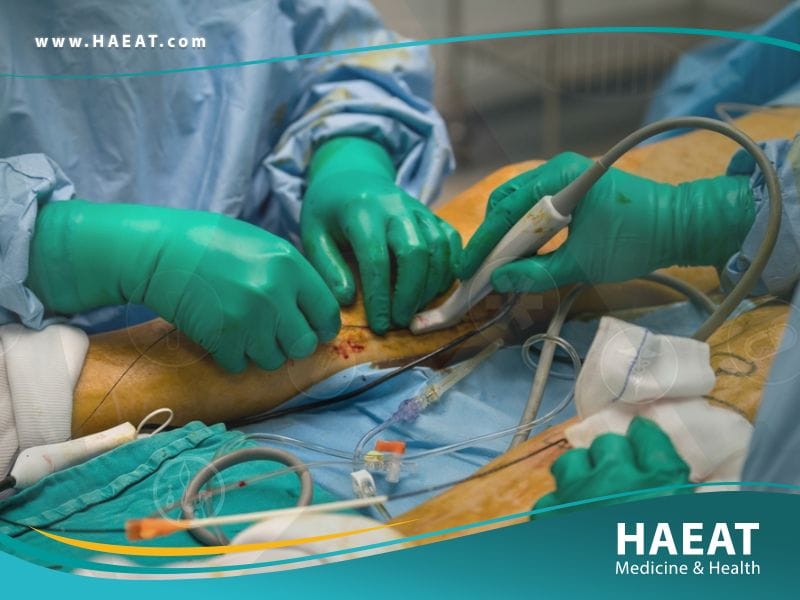 جراحة الأوعية الدموية