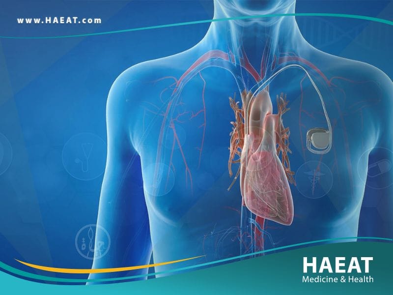 زرع جهاز تنظيم ضربات القلب