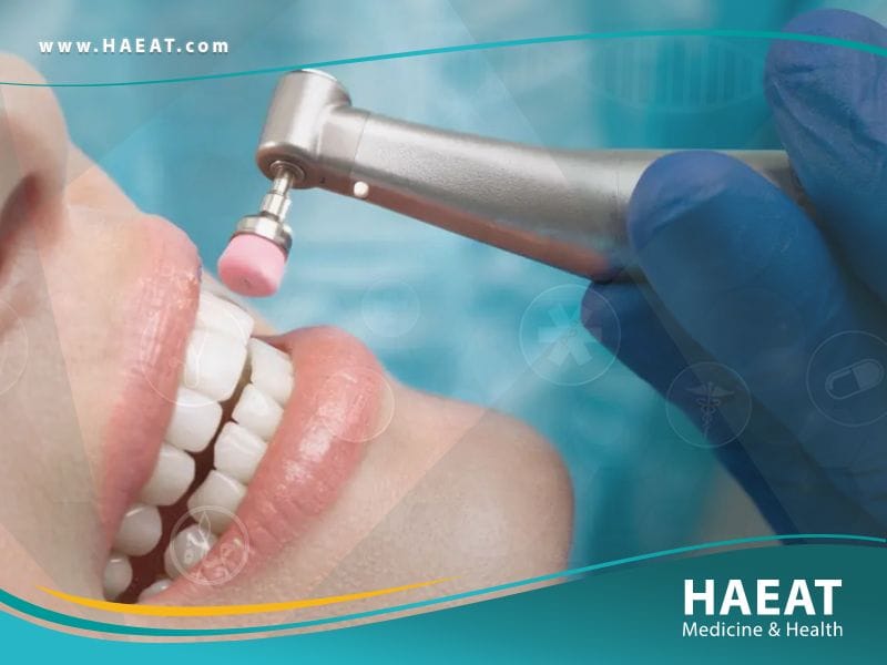 سلامة أسنانك