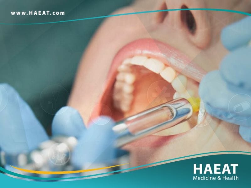 سلامة أسنانك