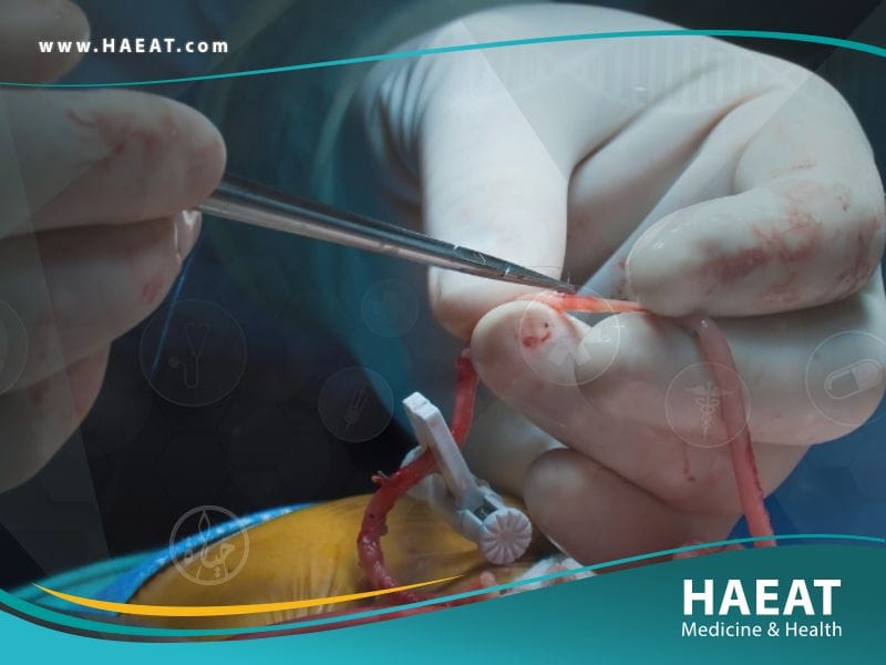 جراحة المجازة التاجية