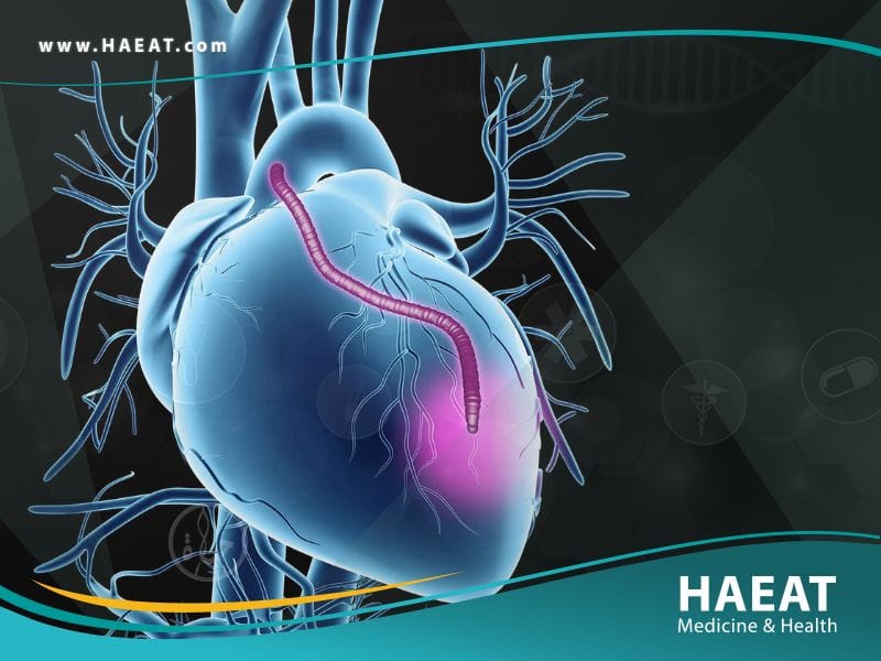 عملية مجازة الشريان التاجي