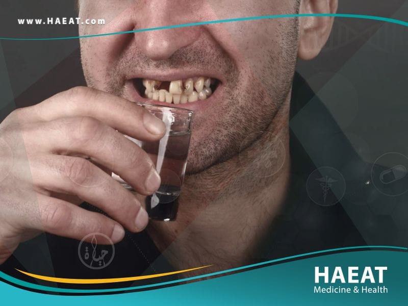 اضرار الجير على اسنانك | 7 أعراض، أسباب، وعلاج 24 اضرار الجير على اسنانك