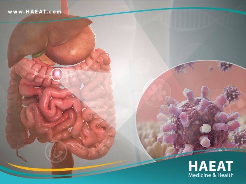 التهاب المعدة والأمعاء