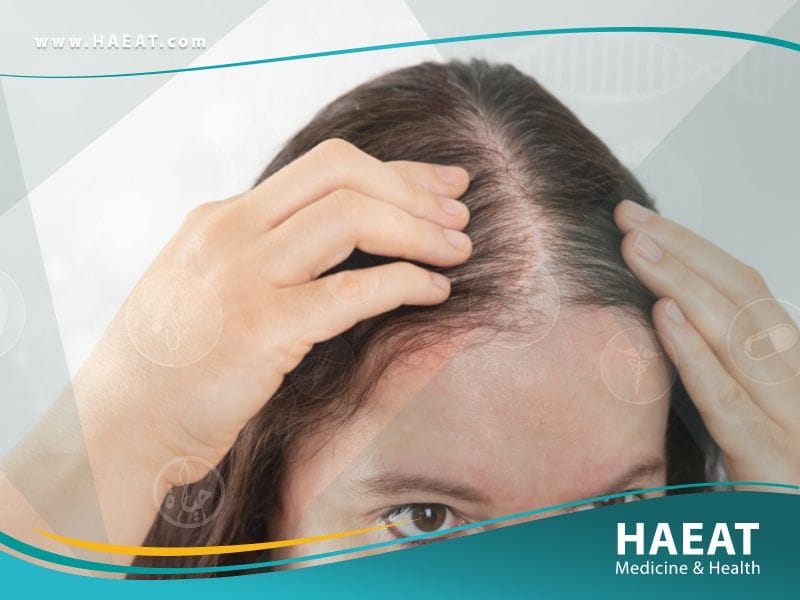 الدول الافضل لزراعة الشعر بالترتيب