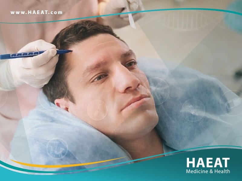 الفرق بين تقنية DHI و FUE