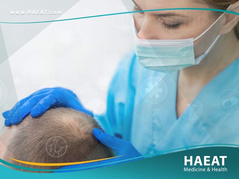 الفرق بين زراعة الشعر بتقنية DHI وتقنية FUE