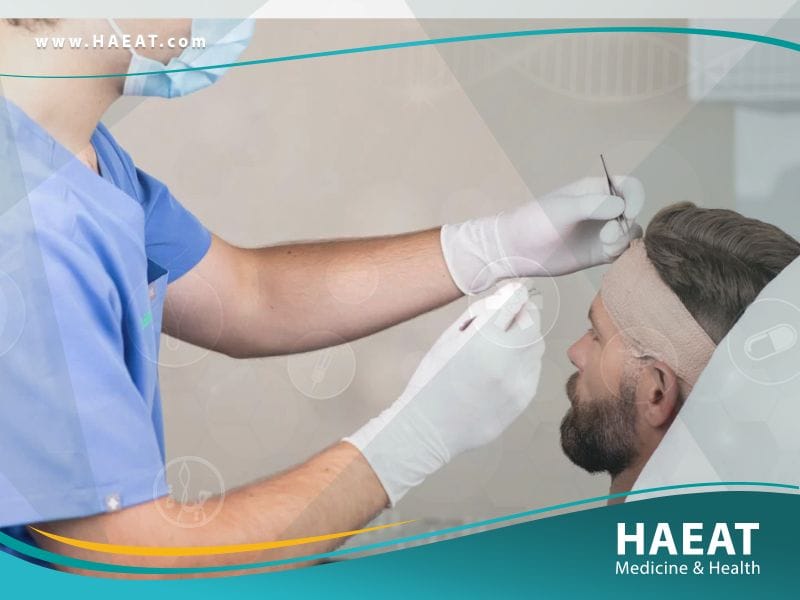 الفرق بين زراعة الشعر بتقنية DHI وتقنية FUE