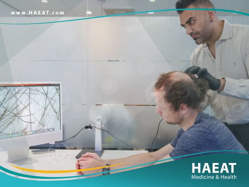 الفرق بين زراعة الشعر بتقنية FUE وتقنية الخلايا الجذعية