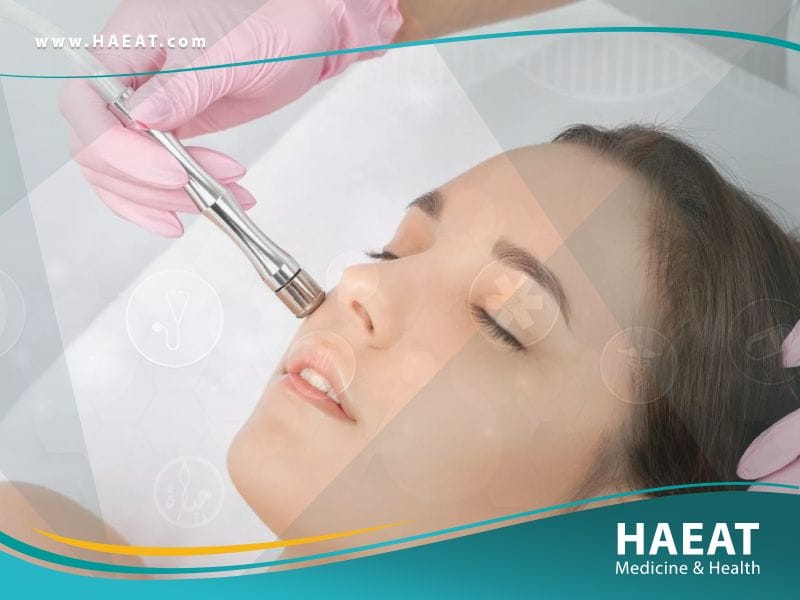 تسحيج الجلد Dermabrasion