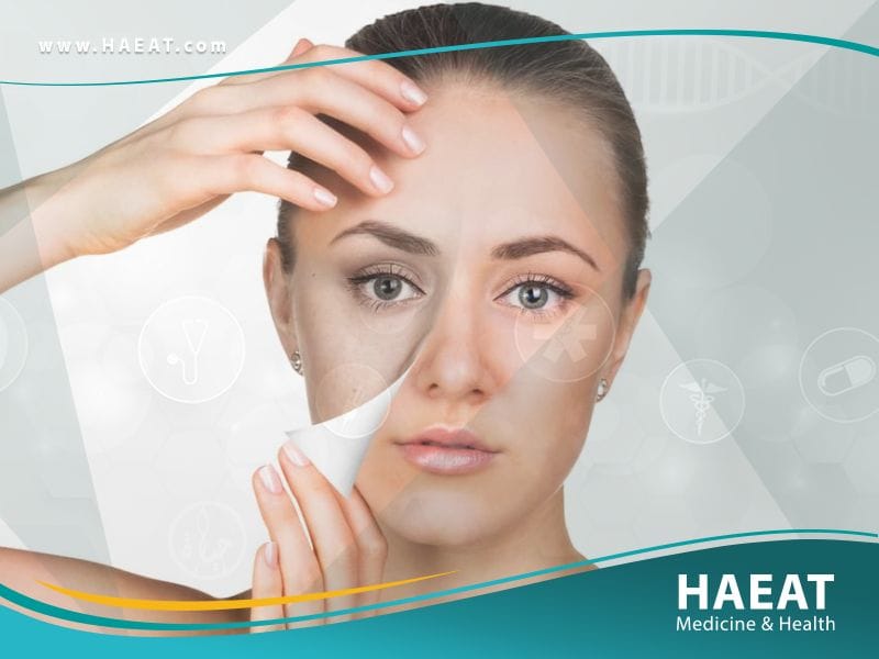 تسحيج الجلد Dermabrasion