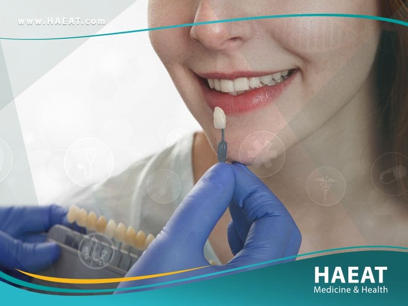 تيجان أسنان الزركونيا
