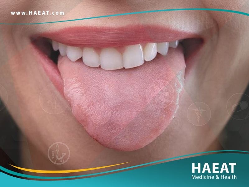 جفاف الفم وصحة الفم