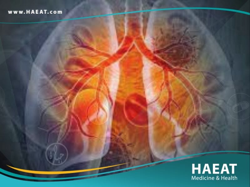 سرطان الرئه