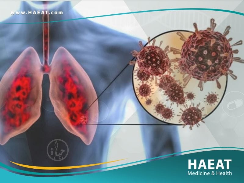 ما هو فيروس كورونا