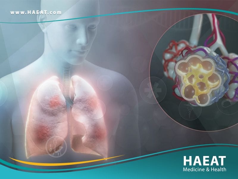 ما هو فيروس كورونا