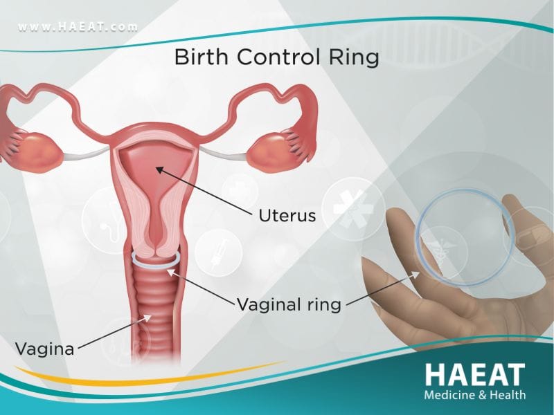 وسائل منع الحمل