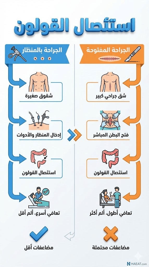 استئصال القولون | 5 نصائح للتعافي 21 image 166