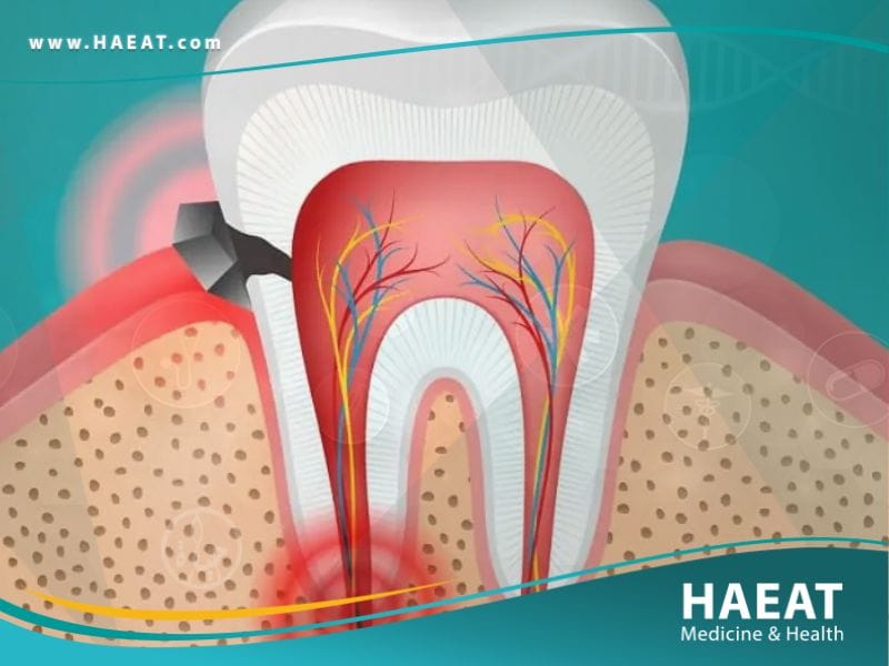 الم الأسنان
