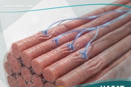 ارتجاف حزمي