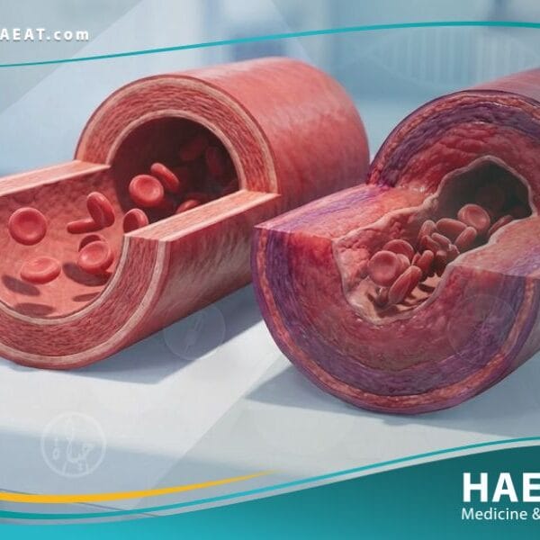 الالتهاب الوعائي