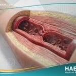 الالتهابات الوريدية