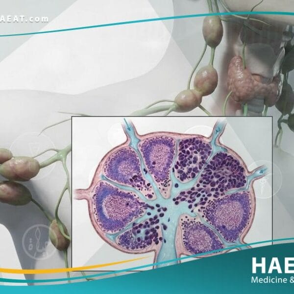 الاورام اللمفاوية