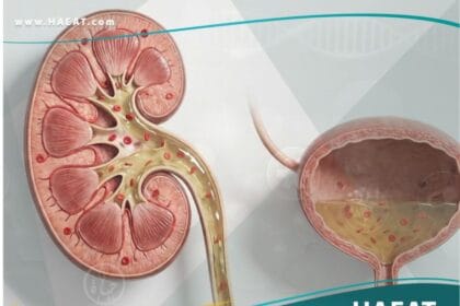 البيلة الدموية