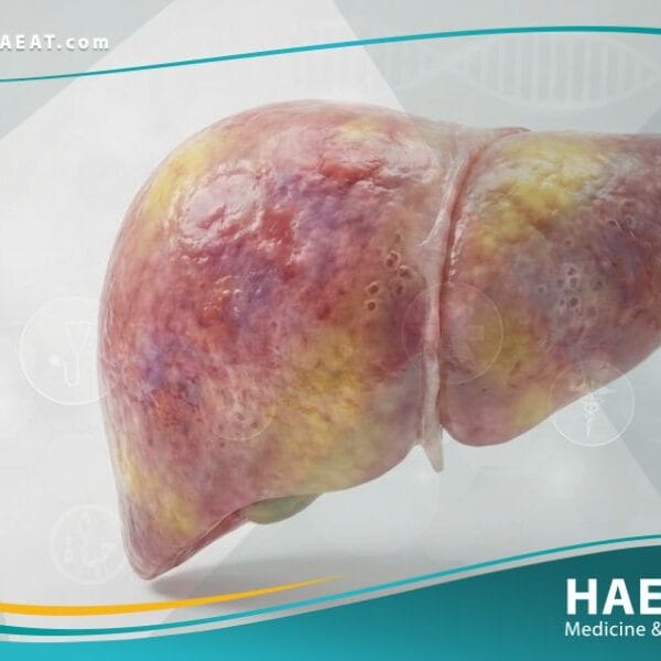 التسمم بالباراسيتامول