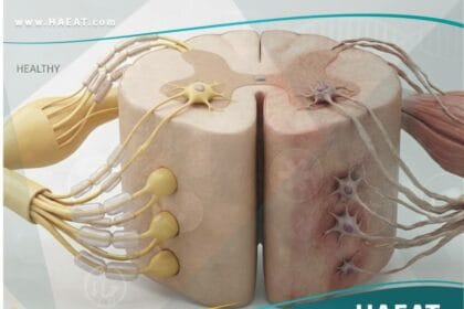 التصلب الجانبي الضموري