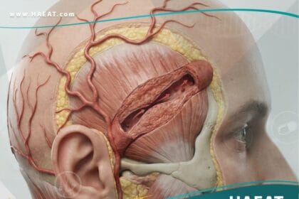 التهاب الشريان الصدغي