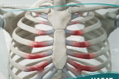 التهاب الغضروف (1)