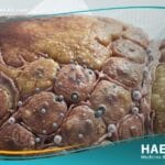 التهاب الكبد ب