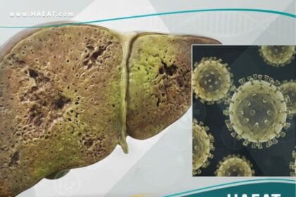 الحمى الصفراء