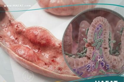 الحمى المعوية