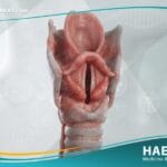 الخناق