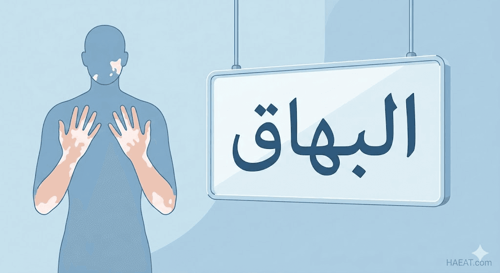 البهاق | 7 حقائق عن الأعراض، الأسباب، والعلاج 21 image 26