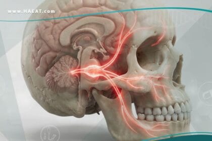 ألم العصب الخامس