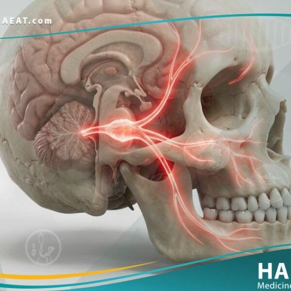 ألم العصب الخامس