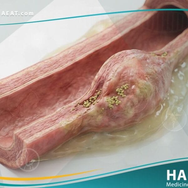 أم الدم العدوائية