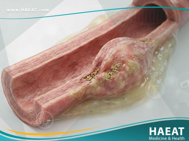 أم الدم العدوائية