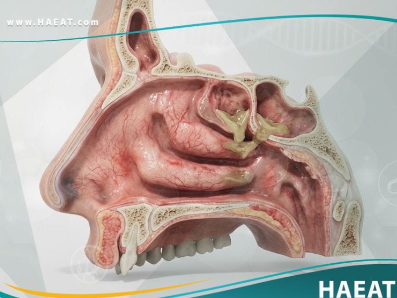 أمراض الأنف