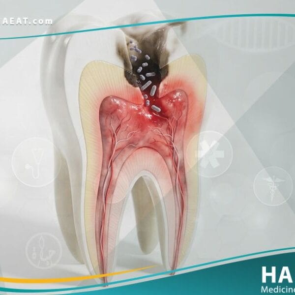 _أمراض التهاب اللب