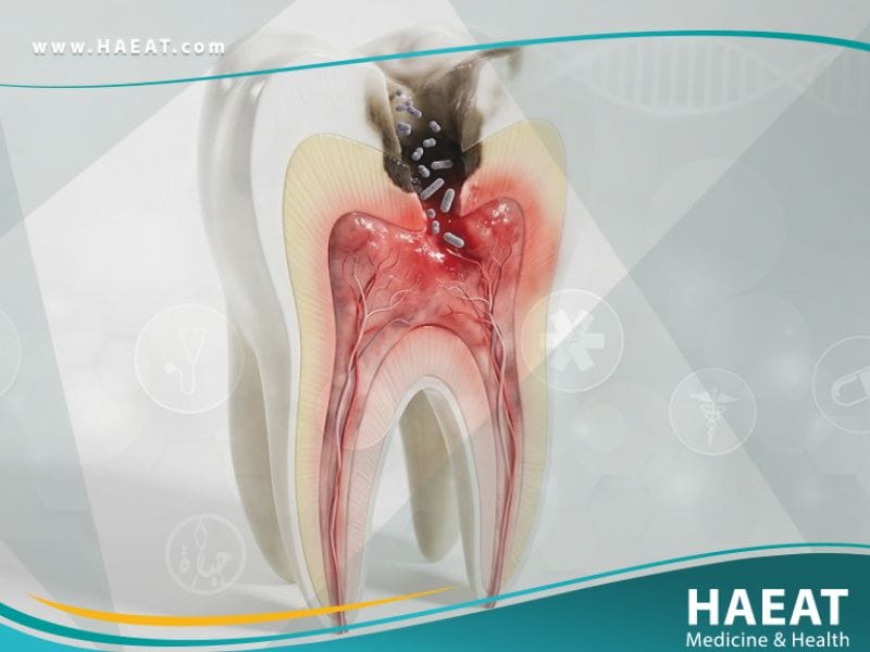 _أمراض التهاب اللب