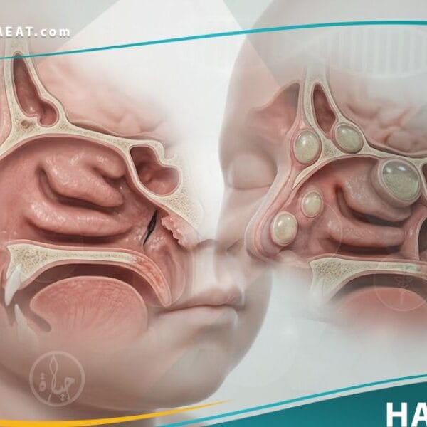 أمراض خلقية في الأنف والجيوب الأنفية