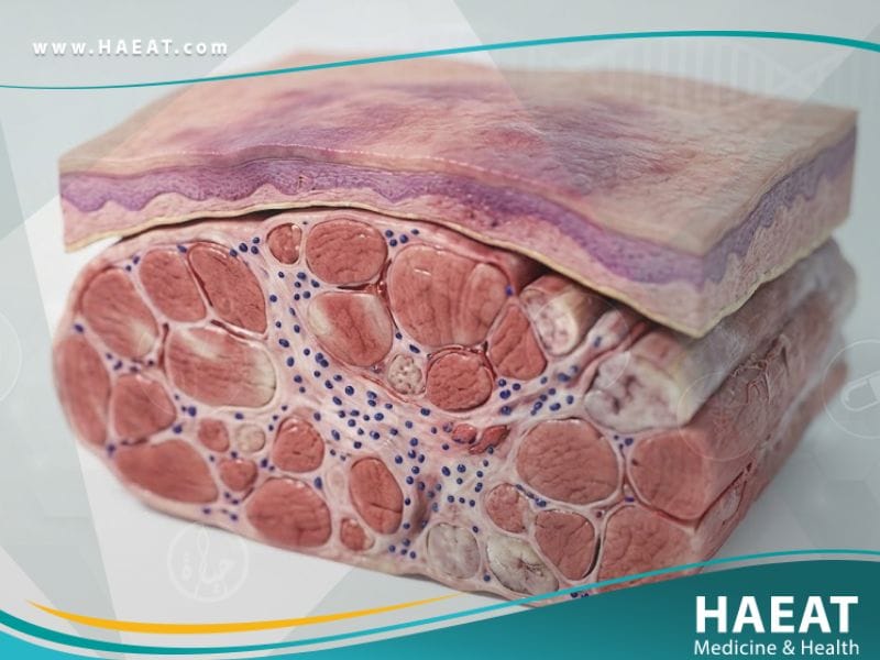 _إلتهاب العضلات والجلد (1)