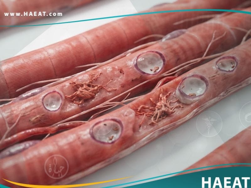 اعتلال عضلي مشتمل